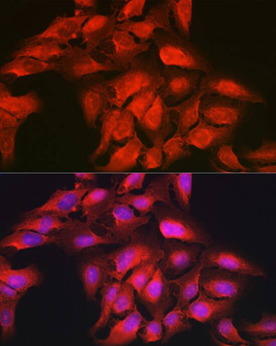 Immunocytochemistry/ Immunofluorescence: GAMT Antibody [NBP3-38293] - Immunofluorescence analysis of U-2 OS cells using GAMT Rabbit pAb at dilution of 1:200 (40x lens). Secondary antibody: Cy3-conjugated Goat anti-Rabbit IgG (H+L) at 1:500 dilution. Blue: DAPI for nuclear staining.