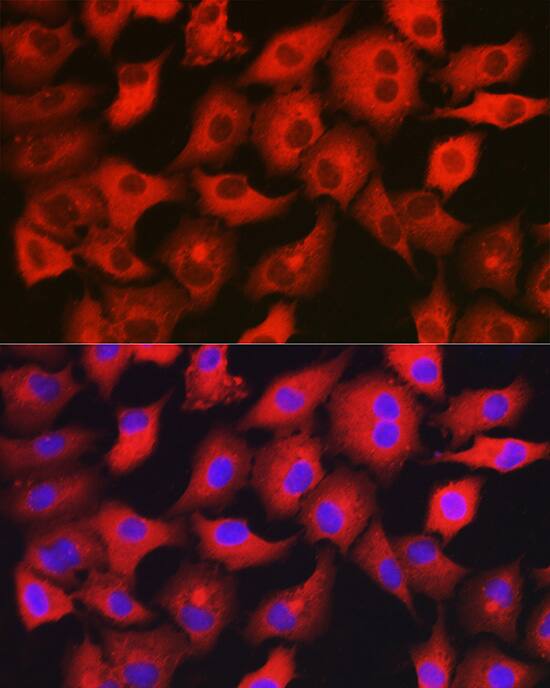 Immunocytochemistry/ Immunofluorescence: GAMT Antibody [NBP3-38293] - Immunofluorescence analysis of A549 cells using GAMT Rabbit pAb at dilution of 1:200 (40x lens). Secondary antibody: Cy3-conjugated Goat anti-Rabbit IgG (H+L) at 1:500 dilution. Blue: DAPI for nuclear staining.