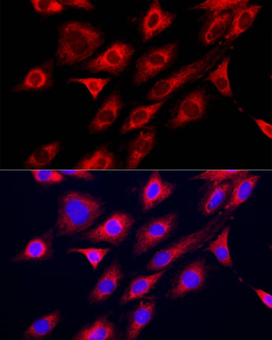 Immunocytochemistry/ Immunofluorescence: GAMT Antibody [NBP3-38293] - Immunofluorescence analysis of C6 cells using GAMT Rabbit pAb at dilution of 1:200 (40x lens). Secondary antibody: Cy3-conjugated Goat anti-Rabbit IgG (H+L) at 1:500 dilution. Blue: DAPI for nuclear staining.