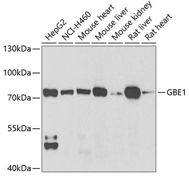 Western Blot: GBE1 Antibody [NBP3-38294] - Western blot analysis of various lysates using GBE1 Rabbit pAb at 1:1000 dilution.Secondary antibody: HRP-conjugated Goat anti-Rabbit IgG (H+L) at 1:10000 dilution.Lysates/proteins: 25ug per lane.Blocking buffer: 3% nonfat dry milk in TBST.Detection: ECL Basic Kit.Exposure time: 90s.