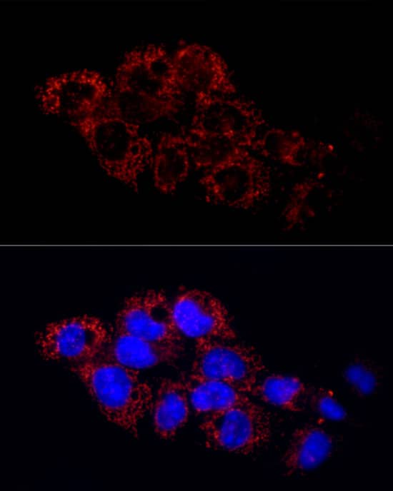 Immunocytochemistry/ Immunofluorescence: Glutamate Dehydrogenase 2/GLUD2 Antibody [NBP3-38295] - Immunofluorescence analysis of HepG2 cells using Glutamate Dehydrogenase 2/GLUD2 Rabbit pAb at dilution of 1:50 (40x lens). Secondary antibody: Cy3-conjugated Goat anti-Rabbit IgG (H+L) at 1:500 dilution. Blue: DAPI for nuclear staining.