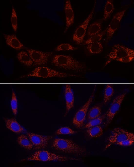 Immunocytochemistry/ Immunofluorescence: Glutamate Dehydrogenase 2/GLUD2 Antibody [NBP3-38295] - Immunofluorescence analysis of NIH/3T3 cells using Glutamate Dehydrogenase 2/GLUD2 Rabbit pAb at dilution of 1:50 (40x lens). Secondary antibody: Cy3-conjugated Goat anti-Rabbit IgG (H+L) at 1:500 dilution. Blue: DAPI for nuclear staining.