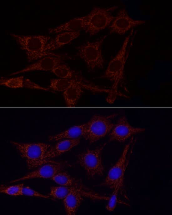 Immunocytochemistry/ Immunofluorescence: Glutamate Dehydrogenase 2/GLUD2 Antibody [NBP3-38295] - Immunofluorescence analysis of PC-12 cells using Glutamate Dehydrogenase 2/GLUD2 Rabbit pAb at dilution of 1:50 (40x lens). Secondary antibody: Cy3-conjugated Goat anti-Rabbit IgG (H+L) at 1:500 dilution. Blue: DAPI for nuclear staining.