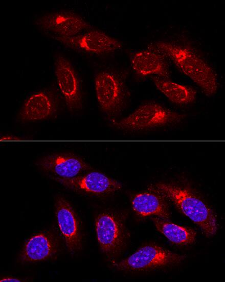 Immunocytochemistry/ Immunofluorescence: GRASP65 Antibody [NBP3-38297] - Confocal immunofluorescence analysis of U2OS cells using GRASP65 Rabbit pAb at dilution of 1:100. Blue: DAPI for nuclear staining.