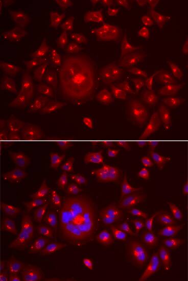 Immunocytochemistry/ Immunofluorescence: GRASP65 Antibody [NBP3-38297] - Immunofluorescence analysis of A549 cells using GRASP65 Rabbit pAb. Secondary antibody: Cy3-conjugated Goat anti-Rabbit IgG (H+L) at 1:500 dilution. Blue: DAPI for nuclear staining.