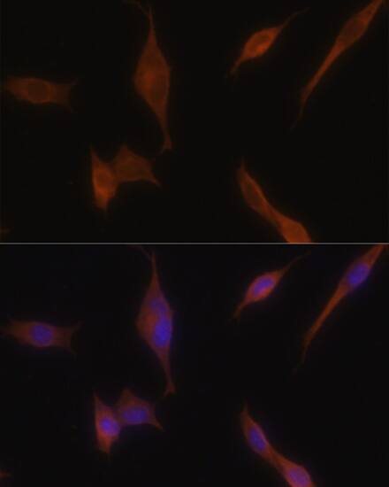 Immunocytochemistry/ Immunofluorescence Melanophilin Antibody