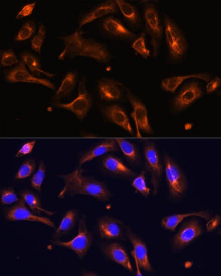 Immunocytochemistry/ Immunofluorescence Melanophilin Antibody