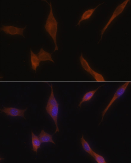 Immunocytochemistry/ Immunofluorescence: Melanophilin Antibody [NBP3-38302] - Immunofluorescence analysis of NIH-3T3 cells using Melanophilin antibody at dilution of 1:100. Blue: DAPI for nuclear staining.