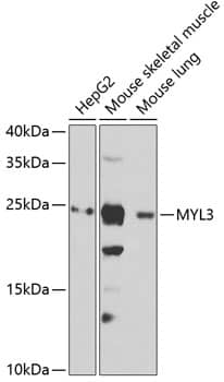Western Blot Myosin light chain 3 Antibody - BSA Free