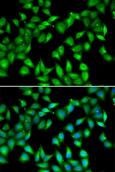 Immunocytochemistry/ Immunofluorescence: Myosin light chain 3 Antibody [NBP3-38303] - Immunofluorescence analysis of U2OS cells using Myosin light chain 3 Rabbit pAb. Secondary antibody: Cy3-conjugated Goat anti-Rabbit IgG (H+L) at 1:500 dilution. Blue: DAPI for nuclear staining.
