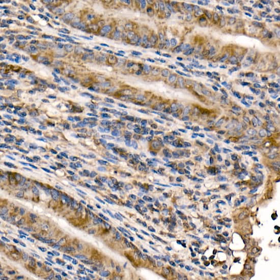 Immunohistochemistry: NFkB p105/p50 Antibody [NBP3-38305] - Immunohistochemistry analysis of paraffin-embedded Mouse intestin using NFkB p105/p50 Rabbit pAb at dilution of 1:50 (40x lens). High pressure antigen retrieval performed with 0.01M Citrate Bufferr (pH 6.0) prior to IHC staining.