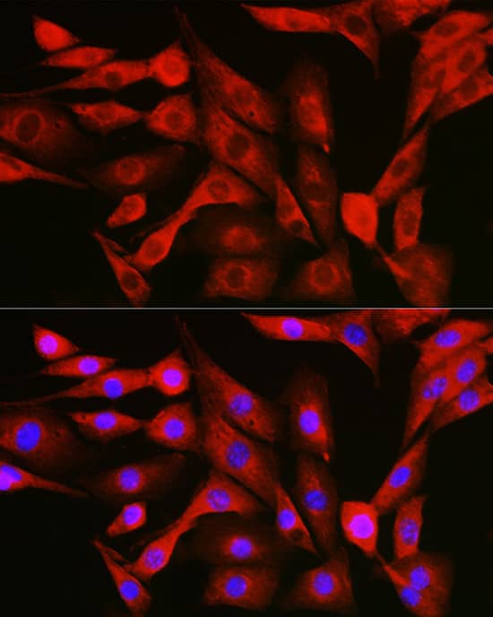 Immunocytochemistry/ Immunofluorescence: NFkB p105/p50 Antibody [NBP3-38305] - Immunofluorescence analysis of NIH/3T3 cells using NFkB p105/p50 Rabbit pAb at dilution of 1:50 (40x lens). Secondary antibody: Cy3-conjugated Goat anti-Rabbit IgG (H+L) at 1:500 dilution. Blue: DAPI for nuclear staining.