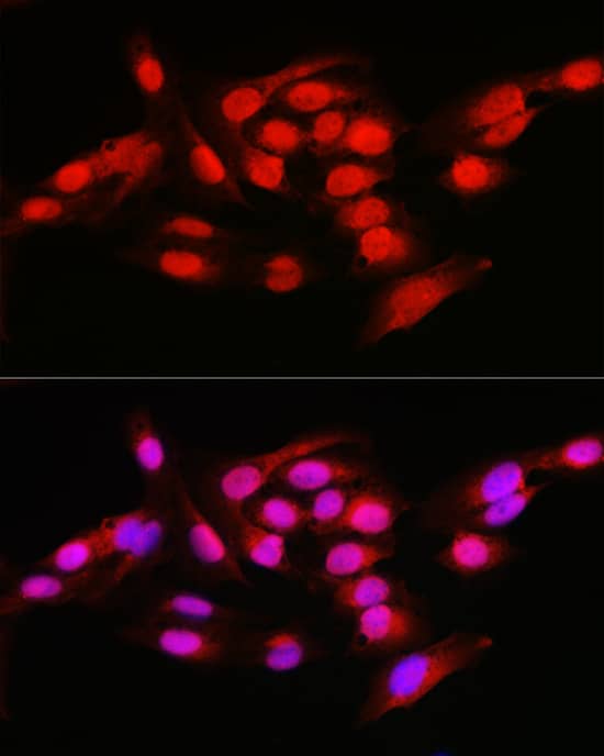 Immunocytochemistry/ Immunofluorescence: NFkB p105/p50 Antibody [NBP3-38305] - Immunofluorescence analysis of U2OS cells using NFkB p105/p50 Rabbit pAb at dilution of 1:50 (40x lens). Secondary antibody: Cy3-conjugated Goat anti-Rabbit IgG (H+L) at 1:500 dilution. Blue: DAPI for nuclear staining.