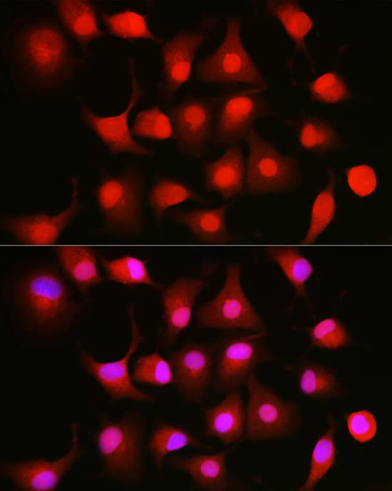 Immunocytochemistry/ Immunofluorescence: NFkB p105/p50 Antibody [NBP3-38305] - Immunofluorescence analysis of A-549 cells using NFkB p105/p50 Rabbit pAb at dilution of 1:50 (40x lens). Secondary antibody: Cy3-conjugated Goat anti-Rabbit IgG (H+L) at 1:500 dilution. Blue: DAPI for nuclear staining.