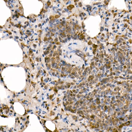 Immunohistochemistry: NFkB p105/p50 Antibody [NBP3-38305] - Immunohistochemistry analysis of paraffin-embedded Rat lung using NFkB p105/p50 Rabbit pAb at dilution of 1:50 (40x lens). High pressure antigen retrieval performed with 0.01M Citrate Bufferr (pH 6.0) prior to IHC staining.