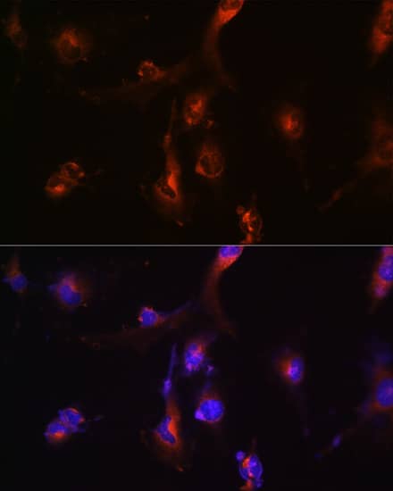 Immunocytochemistry/ Immunofluorescence: NFS1 Antibody [NBP3-38306] - Immunofluorescence analysis of U-251 MG cells using NFS1 Rabbit pAb at dilution of 1:100 (40x lens). Secondary antibody: Cy3-conjugated Goat anti-Rabbit IgG (H+L) at 1:500 dilution. Blue: DAPI for nuclear staining.