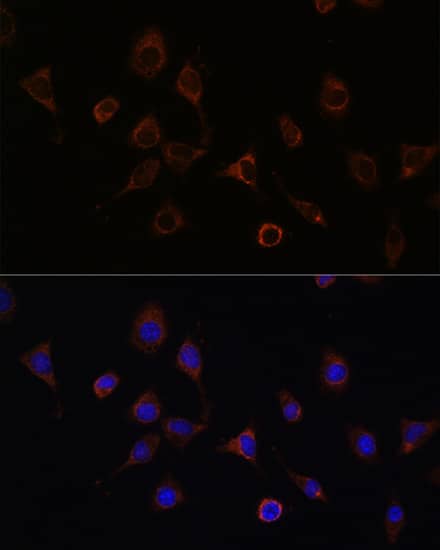 Immunocytochemistry/ Immunofluorescence: NFS1 Antibody [NBP3-38306] - Immunofluorescence analysis of L929 cells using NFS1 Rabbit pAb at dilution of 1:100 (40x lens). Secondary antibody: Cy3-conjugated Goat anti-Rabbit IgG (H+L) at 1:500 dilution. Blue: DAPI for nuclear staining.