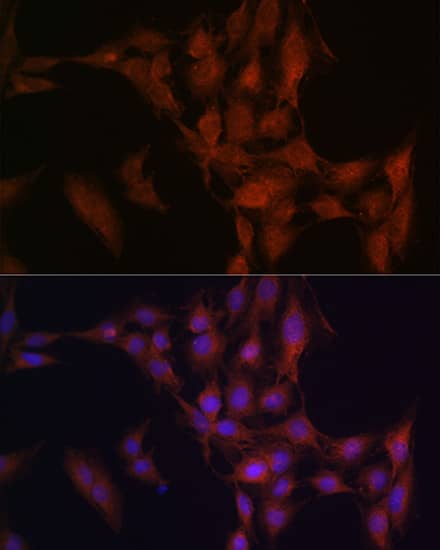 Immunocytochemistry/ Immunofluorescence: NFS1 Antibody [NBP3-38306] - Immunofluorescence analysis of C6 cells using NFS1 Rabbit pAb at dilution of 1:100 (40x lens). Secondary antibody: Cy3-conjugated Goat anti-Rabbit IgG (H+L) at 1:500 dilution. Blue: DAPI for nuclear staining.