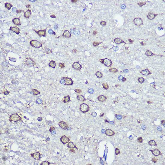 Immunohistochemistry: NFS1 Antibody [NBP3-38306] - Immunohistochemistry analysis of paraffin-embedded Rat brain using NFS1 Rabbit pAb at dilution of 1:100 (40x lens). Microwave antigen retrieval performed with 0.01M PBS Buffer (pH 7.2) prior to IHC staining.