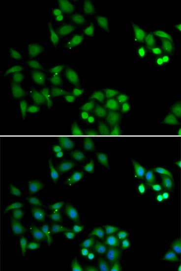 Immunocytochemistry/ Immunofluorescence: NSFL1C Antibody [NBP3-38307] - Immunofluorescence analysis of HeLa cells using NSFL1C Rabbit pAb. Secondary antibody: Cy3-conjugated Goat anti-Rabbit IgG (H+L) at 1:500 dilution. Blue: DAPI for nuclear staining.