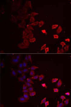Immunocytochemistry/ Immunofluorescence: P2X4 Antibody [NBP3-38308] - Immunofluorescence analysis of MCF7 cells using P2X4 Rabbit pAb. Secondary antibody: Cy3-conjugated Goat anti-Rabbit IgG (H+L) at 1:500 dilution. Blue: DAPI for nuclear staining.