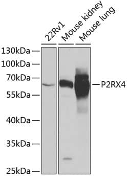 Western Blot: P2X4 Antibody [NBP3-38308] - Western blot analysis of various lysates using P2X4 Rabbit pAb at 1:1000 dilution.Secondary antibody: HRP-conjugated Goat anti-Rabbit IgG (H+L) at 1:10000 dilution.Lysates/proteins: 25ug per lane.Blocking buffer: 3% nonfat dry milk in TBST.Detection: ECL Basic Kit.Exposure time: 30s.