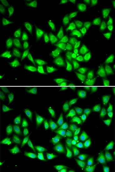 Immunocytochemistry/ Immunofluorescence: PCMT1 Antibody [NBP3-38309] - Immunofluorescence analysis of HeLa cells using PCMT1 Rabbit pAb. Secondary antibody: Cy3-conjugated Goat anti-Rabbit IgG (H+L) at 1:500 dilution. Blue: DAPI for nuclear staining.