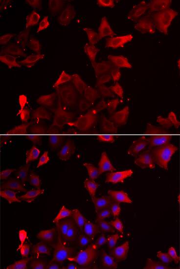 Immunocytochemistry/ Immunofluorescence: PDLIM1 Antibody [NBP3-38310] - Immunofluorescence analysis of U2OS cells using PDLIM1 Rabbit pAb. Secondary antibody: Cy3-conjugated Goat anti-Rabbit IgG (H+L) at 1:500 dilution. Blue: DAPI for nuclear staining.