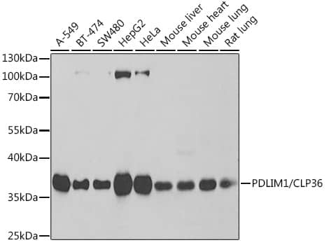 Western Blot: PDLIM1 Antibody [NBP3-38310] - Western blot analysis of various lysates using PDLIM1 Rabbit pAb at 1:1000 dilution.Secondary antibody: HRP-conjugated Goat anti-Rabbit IgG (H+L) at 1:10000 dilution.Lysates/proteins: 25ug per lane.Blocking buffer: 3% nonfat dry milk in TBST.Detection: ECL Basic Kit.Exposure time: 1s.