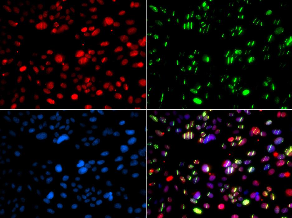 Immunocytochemistry/ Immunofluorescence: PNK Antibody [NBP3-38311] - Immunofluorescence analysis of GFP-RNF168 transgenic U2OS cells using PNK Rabbit pAb. Green: GFP-RNF168 fusion protein expression for DNA damage marker.Secondary antibody: Cy3-conjugated Goat anti-Rabbit IgG (H+L) at 1:500 dilution. Blue: DAPI for nuclear staining. RNF168(GFP) can be used to mark cells damaged by UV-A laser for they always gather around DNA damage region.