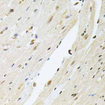Immunohistochemistry: PNK Antibody [NBP3-38311] - Immunohistochemistry analysis of paraffin-embedded Mouse heart using PNK Rabbit pAb at dilution of 1:100 (40x lens). Microwave antigen retrieval performed with 0.01M PBS Buffer (pH 7.2) prior to IHC staining.
