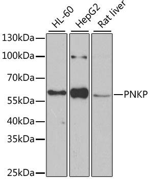 Western Blot: PNK Antibody [NBP3-38311] - Western blot analysis of various lysates using PNK Rabbit pAb at 1:1000 dilution.Secondary antibody: HRP-conjugated Goat anti-Rabbit IgG (H+L) at 1:10000 dilution.Lysates/proteins: 25ug per lane.Blocking buffer: 3% nonfat dry milk in TBST.Detection: ECL Basic Kit.Exposure time: 90s.