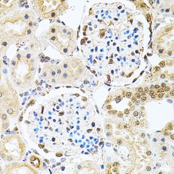Immunohistochemistry: PNK Antibody [NBP3-38311] - Immunohistochemistry analysis of paraffin-embedded Rat kidney using PNK Rabbit pAb at dilution of 1:100 (40x lens). Microwave antigen retrieval performed with 0.01M PBS Buffer (pH 7.2) prior to IHC staining.
