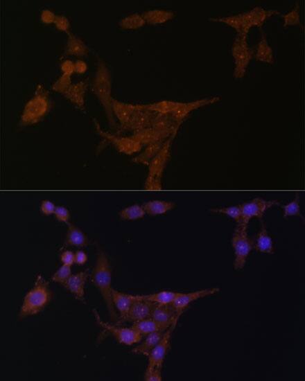 Immunocytochemistry/ Immunofluorescence: Phosphoribosyl Pyrophosphate Amidotransferase Antibody [NBP3-38312] - Immunofluorescence analysis of HeLa cells using Phosphoribosyl Pyrophosphate Amidotransferase Rabbit pAb at dilution of 1:100 (40x lens). Secondary antibody: Cy3-conjugated Goat anti-Rabbit IgG (H+L) at 1:500 dilution. Blue: DAPI for nuclear staining.