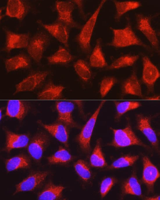 Immunocytochemistry/ Immunofluorescence: PYGL Antibody [NBP3-38314] - Immunofluorescence analysis of HeLa cells using PYGL Rabbit pAb at dilution of 1:100 (40x lens). Secondary antibody: Cy3-conjugated Goat anti-Rabbit IgG (H+L) at 1:500 dilution. Blue: DAPI for nuclear staining.