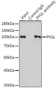 Immunoprecipitation: PYGL Antibody [NBP3-38314] - Immunoprecipitation analysis of 300 ug extracts of HeLa cells using 3 ug PYGL antibody. Western blot was performed from the immunoprecipitate using PYGL antibody at a dilution of 1:1000.