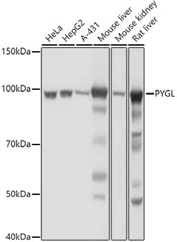 Western Blot: PYGL Antibody [NBP3-38314] - Western blot analysis of various lysates using PYGL Rabbit pAb at 1:1000 dilution.Secondary antibody: HRP-conjugated Goat anti-Rabbit IgG (H+L) at 1:10000 dilution.Lysates/proteins: 25ug per lane.Blocking buffer: 3% nonfat dry milk in TBST.Detection: ECL Basic Kit.Exposure time: 1s.