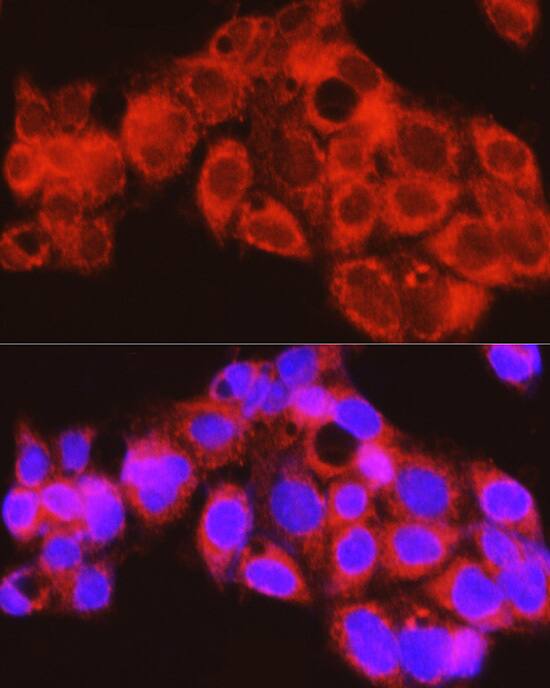 Immunocytochemistry/ Immunofluorescence: PYGL Antibody [NBP3-38314] - Immunofluorescence analysis of HepG2 cells using PYGL Rabbit pAb at dilution of 1:100 (40x lens). Secondary antibody: Cy3-conjugated Goat anti-Rabbit IgG (H+L) at 1:500 dilution. Blue: DAPI for nuclear staining.