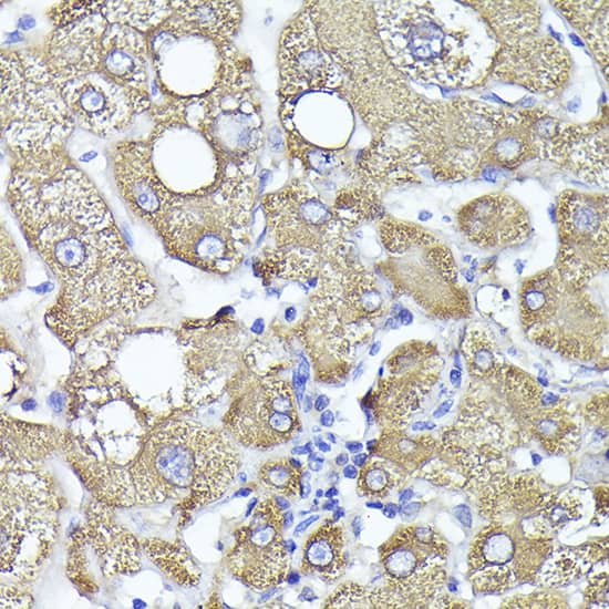 Immunohistochemistry: PYGL Antibody [NBP3-38314] - Immunohistochemistry analysis of paraffin-embedded Human liver using PYGL Rabbit pAb at dilution of 1:100 (40x lens). High pressure antigen retrieval performed with 0.01M Citrate Bufferr (pH 6.0) prior to IHC staining.