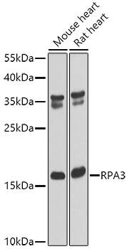 Western Blot: RPA14 Antibody [NBP3-38316] - Western blot analysis of various lysates using RPA14 Rabbit pAb at 1:1000 dilution.Secondary antibody: HRP-conjugated Goat anti-Rabbit IgG (H+L) at 1:10000 dilution.Lysates/proteins: 25ug per lane.Blocking buffer: 3% nonfat dry milk in TBST.Detection: ECL Basic Kit.Exposure time: 60s.