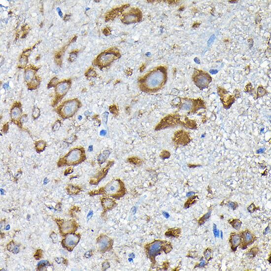 Immunohistochemistry: RPS14 Antibody [NBP3-38318] - Immunohistochemistry analysis of paraffin-embedded Mouse spinal cord using RPS14 Rabbit pAb at dilution of 1:200 (40x lens). High pressure antigen retrieval performed with 0.01M Citrate Bufferr (pH 6.0) prior to IHC staining.