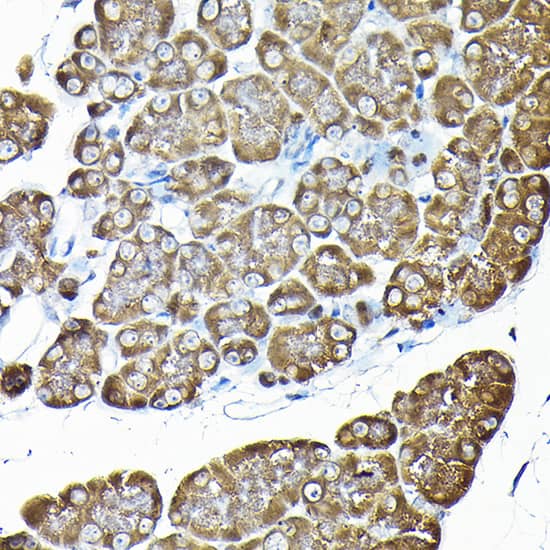 Immunohistochemistry: RPS14 Antibody [NBP3-38318] - Immunohistochemistry analysis of paraffin-embedded Rat pancreas using RPS14 Rabbit pAb at dilution of 1:200 (40x lens). High pressure antigen retrieval performed with 0.01M Citrate Bufferr (pH 6.0) prior to IHC staining.