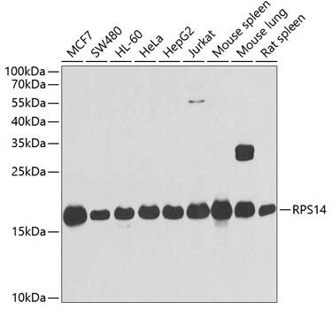 Western Blot: RPS14 Antibody [NBP3-38318] - Western blot analysis of various lysates using RPS14 Rabbit pAb at 1:1000 dilution.Secondary antibody: HRP-conjugated Goat anti-Rabbit IgG (H+L) at 1:10000 dilution.Lysates/proteins: 25ug per lane.Blocking buffer: 3% nonfat dry milk in TBST.Detection: ECL Basic Kit.Exposure time: 30s.