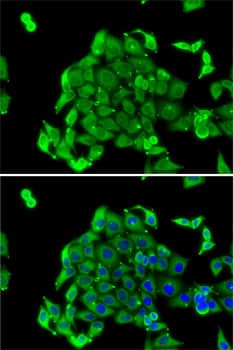 Immunocytochemistry/ Immunofluorescence: RPS14 Antibody [NBP3-38318] - Immunofluorescence analysis of MCF7 cells using RPS14 Rabbit pAb. Secondary antibody: Cy3-conjugated Goat anti-Rabbit IgG (H+L) at 1:500 dilution. Blue: DAPI for nuclear staining.