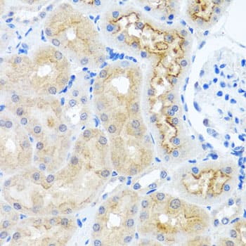 Immunohistochemistry: RPS2 Antibody [NBP3-38319] - Immunohistochemistry analysis of paraffin-embedded Rat kidney using RPS2 Rabbit pAb at dilution of 1:100 (40x lens). Microwave antigen retrieval performed with 0.01M PBS Buffer (pH 7.2) prior to IHC staining.