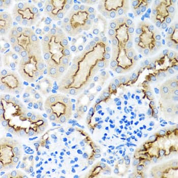 Immunohistochemistry: RPS2 Antibody [NBP3-38319] - Immunohistochemistry analysis of paraffin-embedded Mouse kidney using RPS2 Rabbit pAb at dilution of 1:100 (40x lens). Microwave antigen retrieval performed with 0.01M PBS Buffer (pH 7.2) prior to IHC staining.