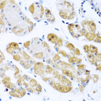 Immunohistochemistry: RPS2 Antibody [NBP3-38319] - Immunohistochemistry analysis of paraffin-embedded Human stomach using RPS2 Rabbit pAb at dilution of 1:100 (40x lens). Microwave antigen retrieval performed with 0.01M PBS Buffer (pH 7.2) prior to IHC staining.