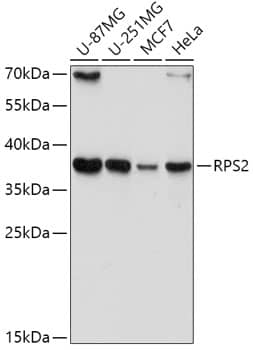 Western Blot: RPS2 Antibody [NBP3-38319] - Western blot analysis of various lysates using RPS2 Rabbit pAb at 1:1000 dilution.Secondary antibody: HRP-conjugated Goat anti-Rabbit IgG (H+L) at 1:10000 dilution.Lysates/proteins: 25ug per lane.Blocking buffer: 3% nonfat dry milk in TBST.Detection: ECL Basic Kit.Exposure time: 15s.