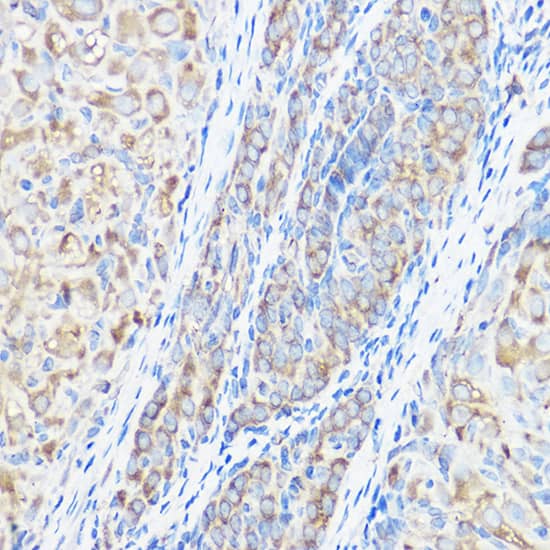 Immunohistochemistry: Seryl tRNA synthetase Antibody [NBP3-38321] - Immunohistochemistry analysis of paraffin-embedded Rat ovary using Seryl tRNA synthetase Rabbit pAb at dilution of 1:50 (40x lens). High pressure antigen retrieval performed with 0.01M Citrate Bufferr (pH 6.0) prior to IHC staining.