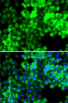 Immunocytochemistry/ Immunofluorescence: Seryl tRNA synthetase Antibody [NBP3-38321] - Immunofluorescence analysis of MCF7 cells using Seryl tRNA synthetase Rabbit pAb. Secondary antibody: Cy3-conjugated Goat anti-Rabbit IgG (H+L) at 1:500 dilution. Blue: DAPI for nuclear staining.